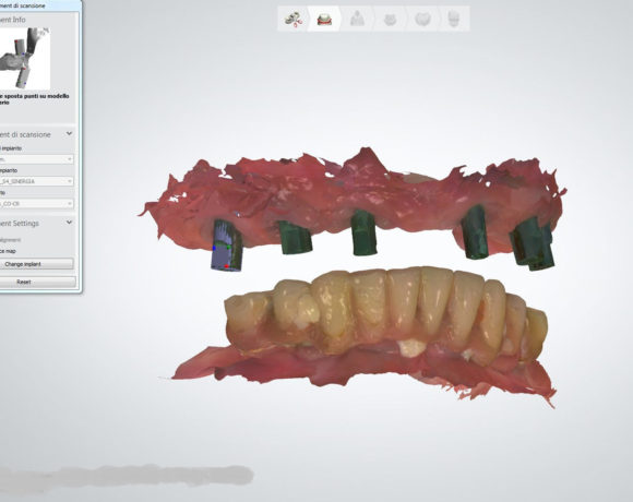 Impronta digitale lavorazione in CAD finalizzazione in composito