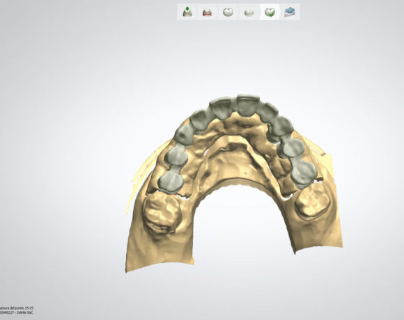 Lavorazione Cad Cam in zirconio